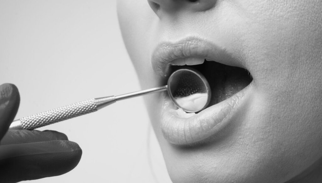 Igiene dentale professionale