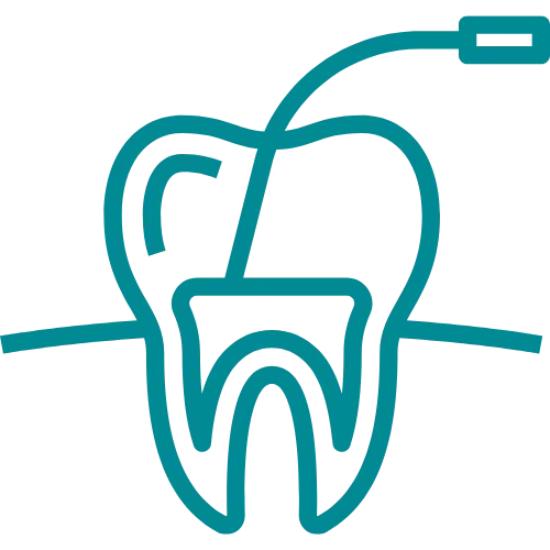 Home 18 Devitalizzazione dente a Torino